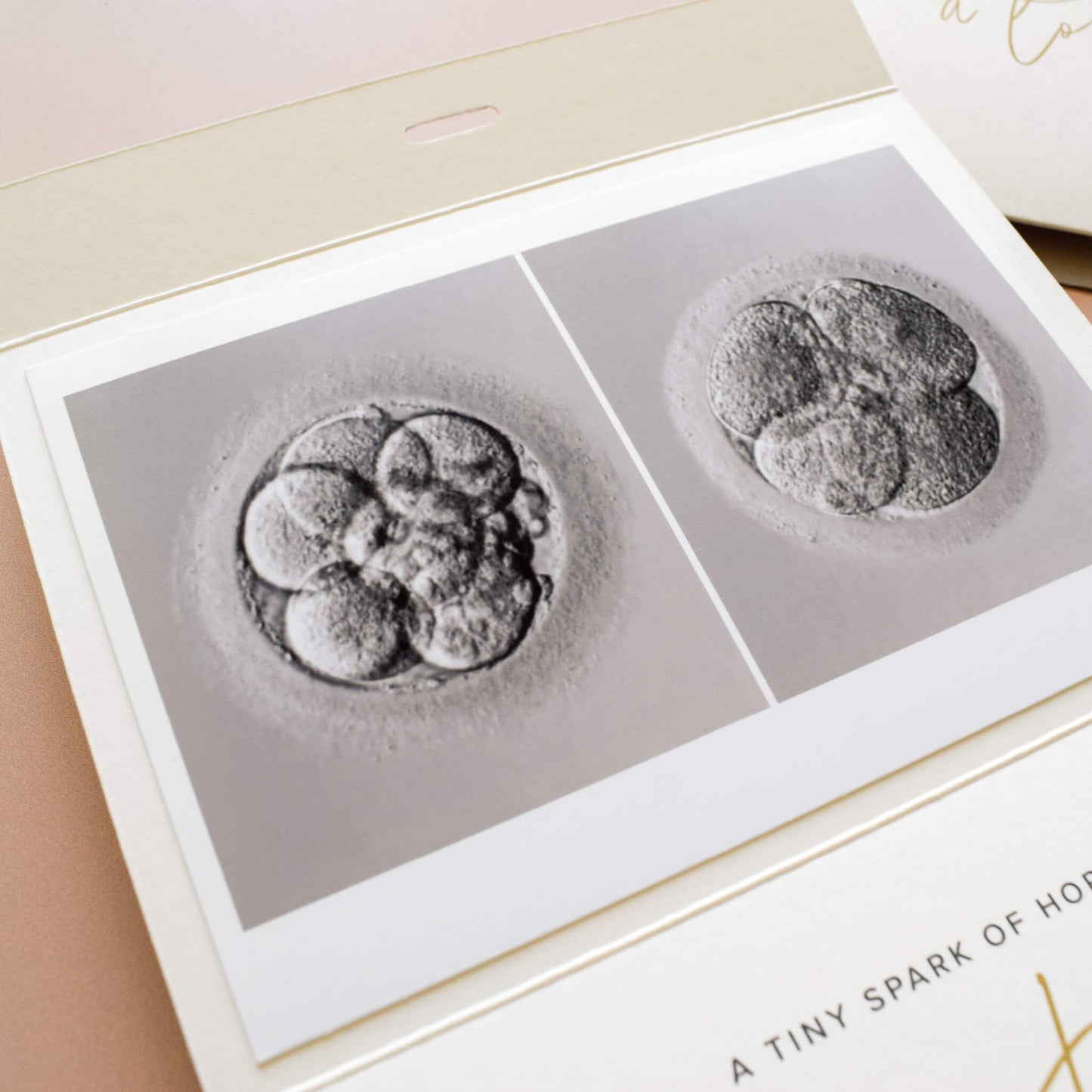 IVF One Step Closer Keepsake Card