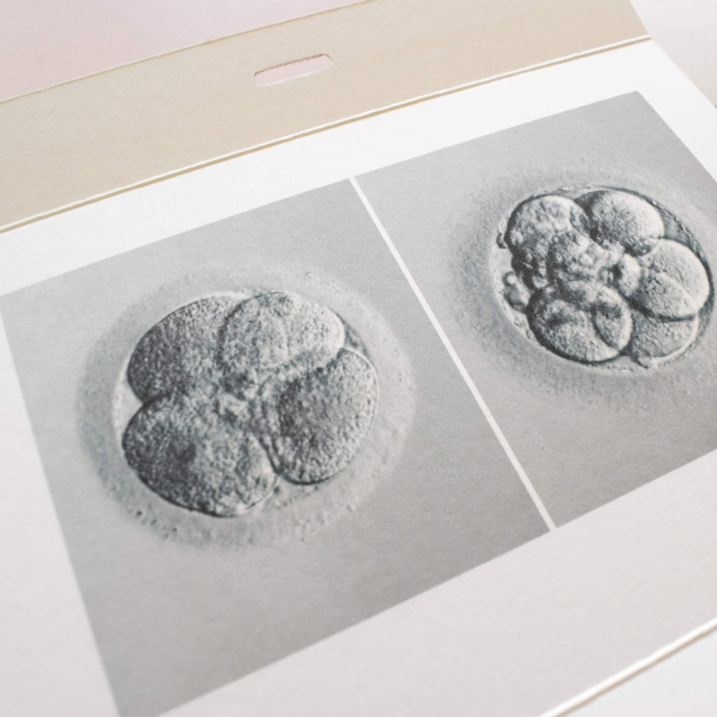 IVF One Step Closer Keepsake Card